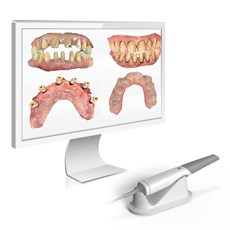 Intraoral Scanner Cameo Elegant 3